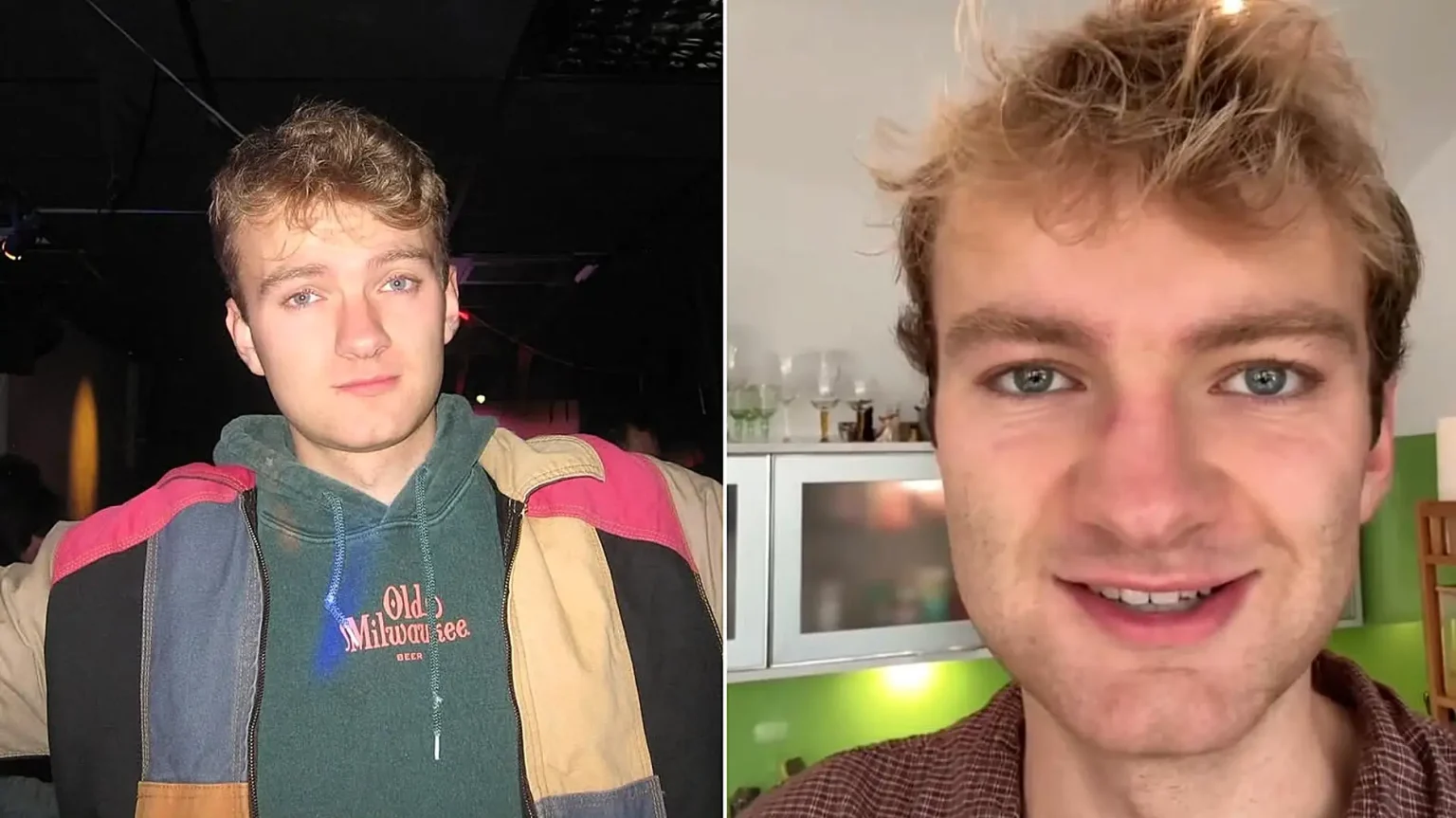 YouTube star TommyInnit has begged fans not to punch him in the face - after claiming a "drunk Irish man" attacked him in public, leaving his eye red.