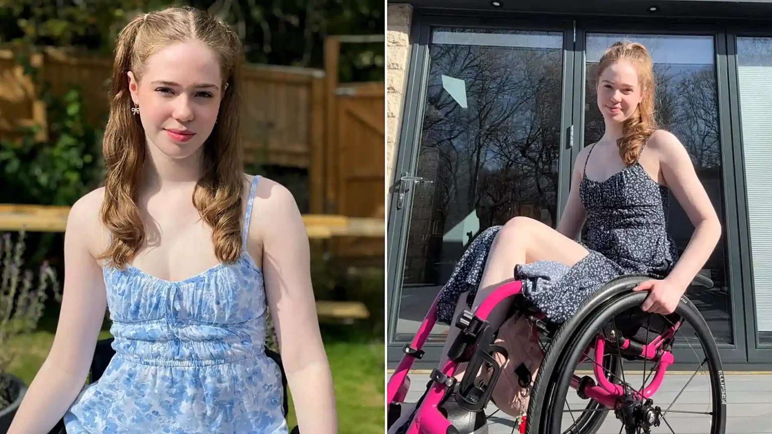 A woman had her leg amputated at 20 after pain that felt like burning alive left her unable to leave the house for eight months - and says it was worth it.
