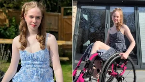 A woman had her leg amputated at 20 after pain that felt like burning alive left her unable to leave the house for eight months - and says it was worth it.