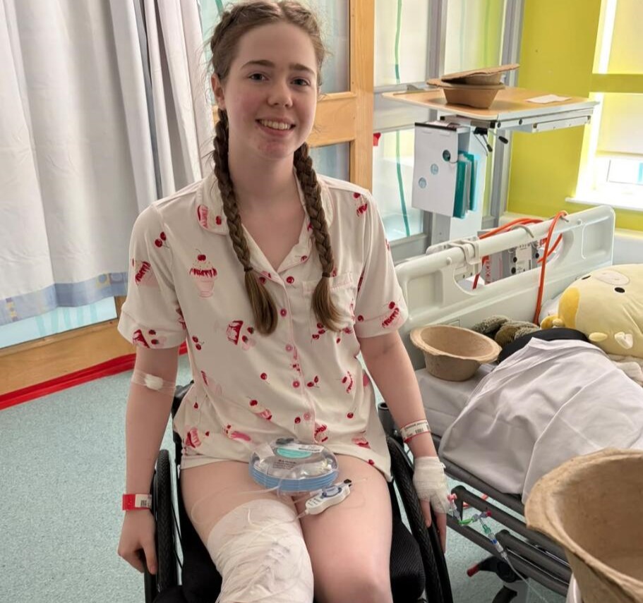 A woman had her leg amputated at 20 after pain that felt like burning alive left her unable to leave the house for eight months - and says it was worth it.