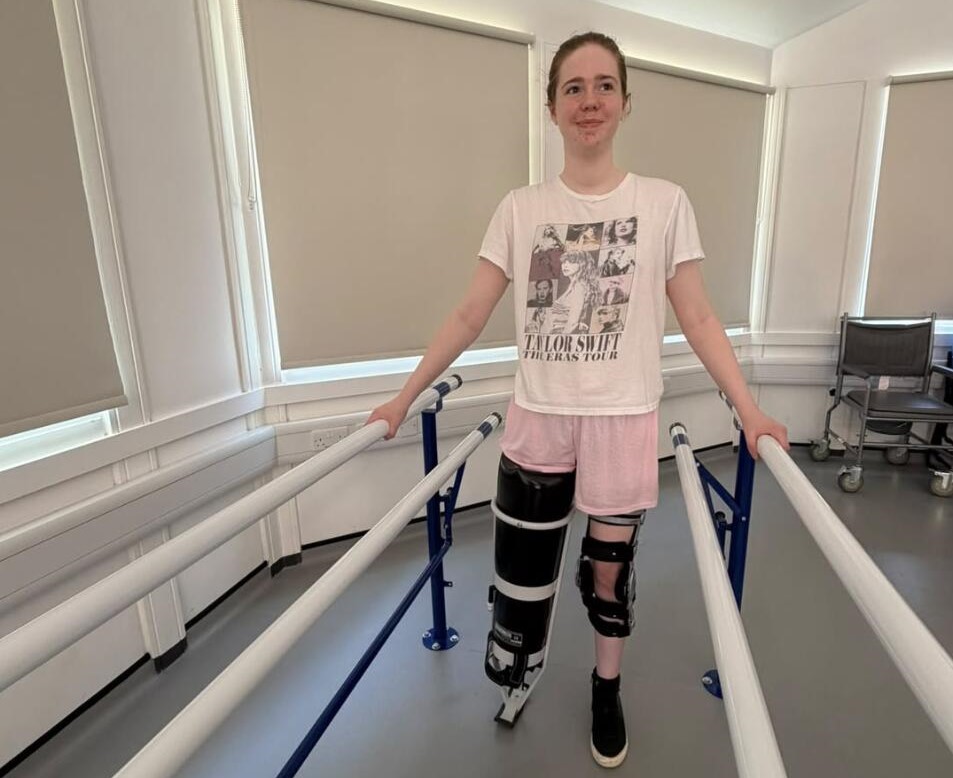 A woman had her leg amputated at 20 after pain that felt like burning alive left her unable to leave the house for eight months - and says it was worth it.