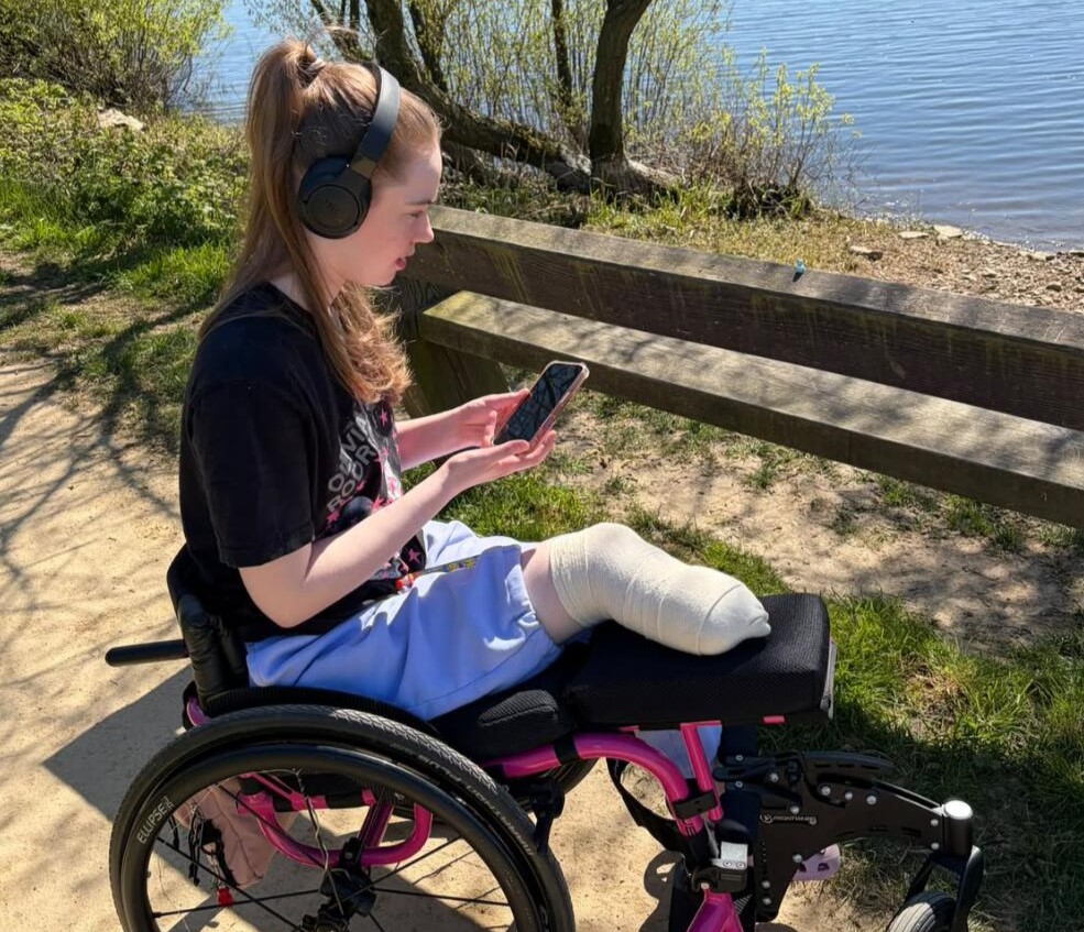 A woman had her leg amputated at 20 after pain that felt like burning alive left her unable to leave the house for eight months - and says it was worth it.