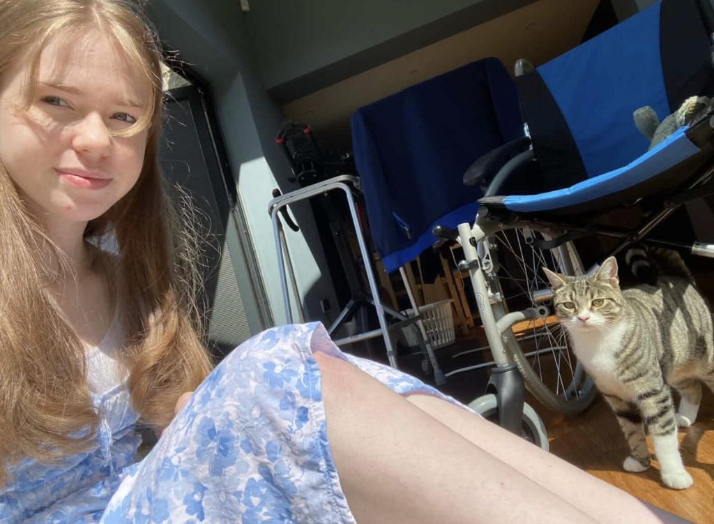A woman had her leg amputated at 20 after pain that felt like burning alive left her unable to leave the house for eight months - and says it was worth it.