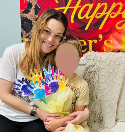 A woman's puberty 'pimple' turned out to be a permanent blood clot on her face that has grown for 19 years - and she can feel her pulse throbbing through it.