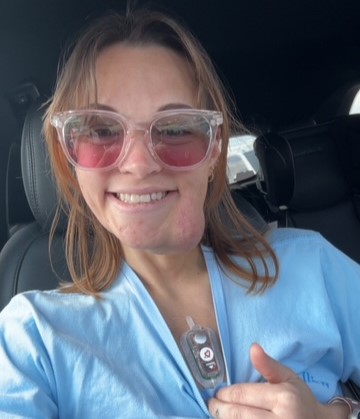A woman's puberty 'pimple' turned out to be a permanent blood clot on her face that has grown for 19 years - and she can feel her pulse throbbing through it.