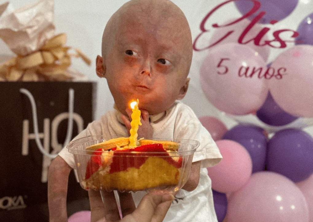 A five-year-old social media star believed to be one of the world's only twins with a rare rapid ageing syndrome has died, her family announced to 1m Instagram followers.