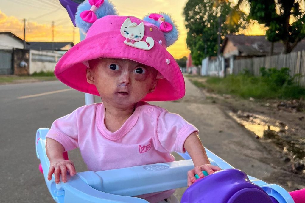 A five-year-old social media star believed to be one of the world's only twins with a rare rapid ageing syndrome has died, her family announced to 1m Instagram followers.