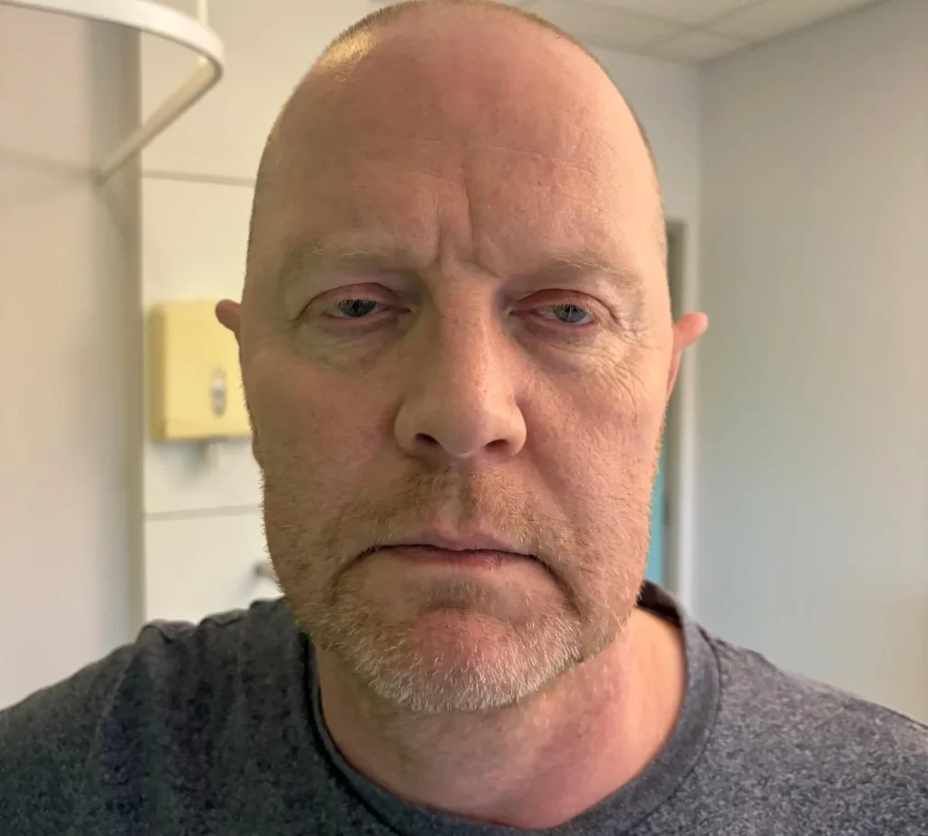 Man's head and shoulders in hospital bathroom mirror.