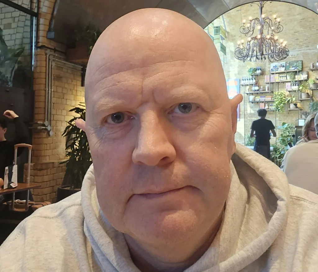 Man looking directly at camera in hospital setting.