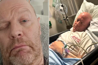 Left: Man smiling with family before stroke. Right: Close-up showing left-side facial weakness after stroke.