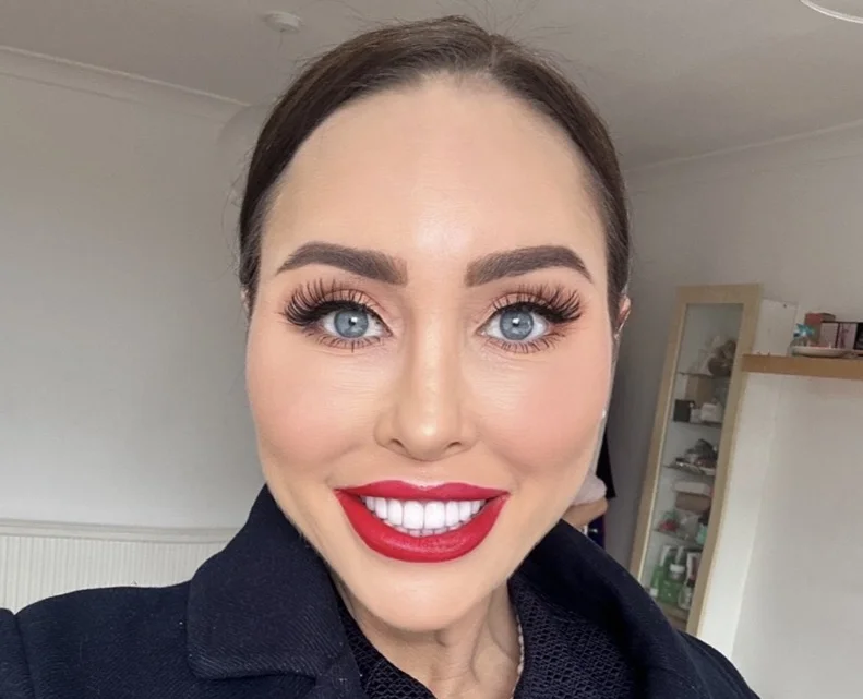 Ex on the Beach star warns of topical steroid withdrawal after spending £380k on cosmetic surgery left her severely disfigured and bedbound for weeks at a time.