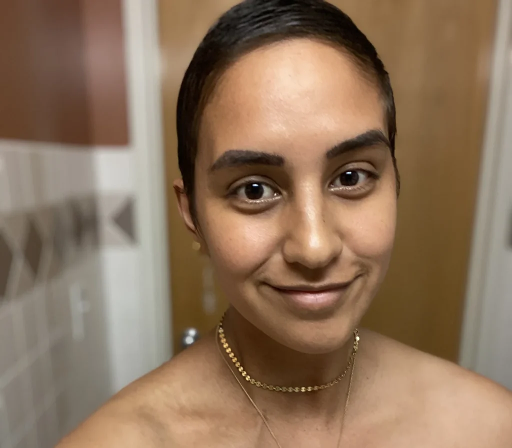 Bald woman wearing gold chain necklace and white bandages on chest in hospital