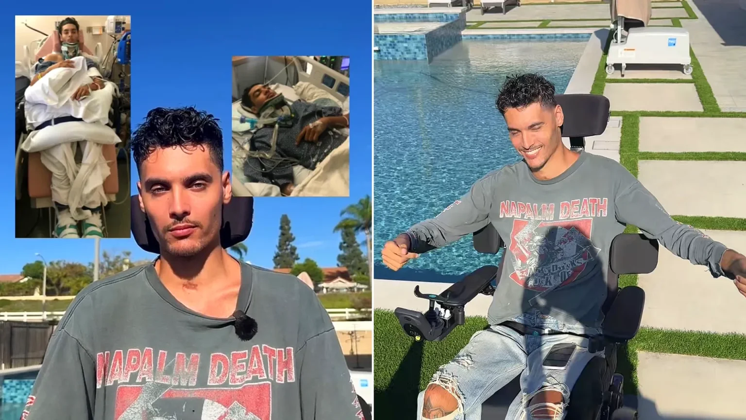 Model left paralysed from chest down after diving into mislabelled shallow pool. Now 27, Isaac Lambert has gone viral sharing his story of survival and seven surgeries.