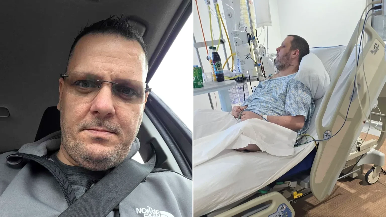 Man thought he had piles but a painful abscess turned into flesh-eating infection Fournier's gangrene, leaving him fighting for his life in intensive care with sepsis.