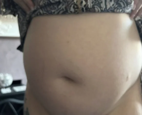 Woman thought she was too young for cancer until a bath incident revealed ovarian cancer diagnosis. Rising cancer rates in under-50s in England highlighted by new statistics.