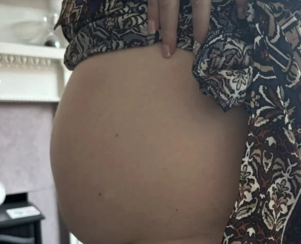 Woman thought she was too young for cancer until a bath incident revealed ovarian cancer diagnosis. Rising cancer rates in under-50s in England highlighted by new statistics.