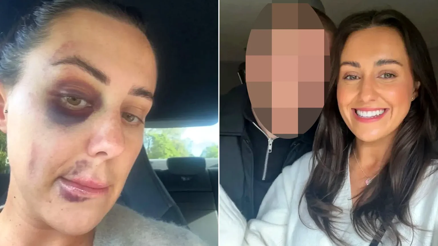 Left: smiling woman in red dress at coast. Right: same woman's bruised face showing severe injuries