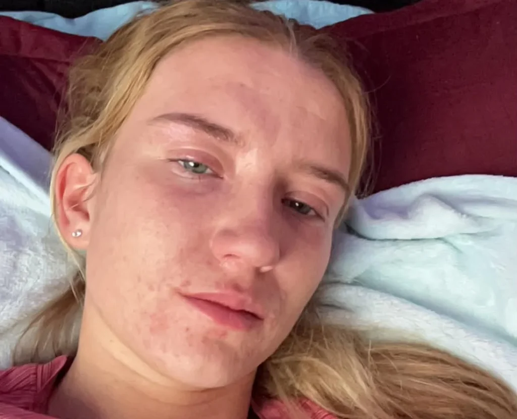 Woman's four-year ketamine addiction destroyed her bladder, leaving it able to hold just 100ml after she spent £10,000 on the drug in one month.