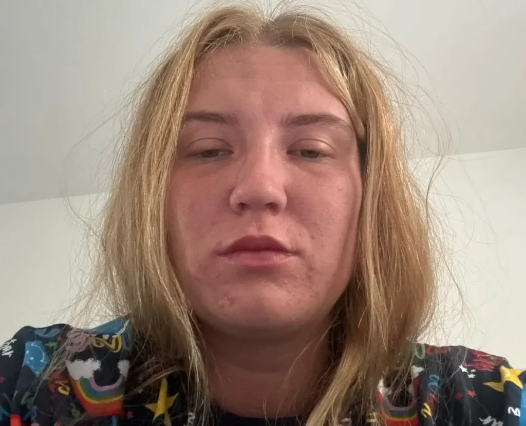 Woman's four-year ketamine addiction destroyed her bladder, leaving it able to hold just 100ml after she spent £10,000 on the drug in one month.