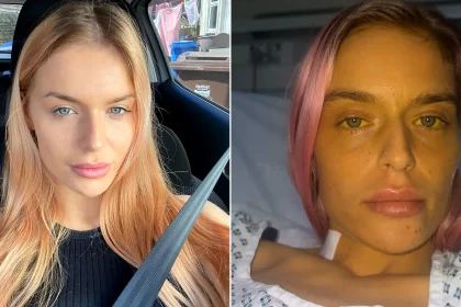 Left: Georgia Lee Hampshire with healthy complexion and reddish hair. Right: Same woman with severe jaundicing, yellow skin and eyes, in hospital bed.