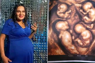Mum-to-be, 38, pregnant with four identical boys in a 'one-in-15 million' miracle. The monozygotic quadruplets share the same placenta in this exceptional Colombian pregnancy.