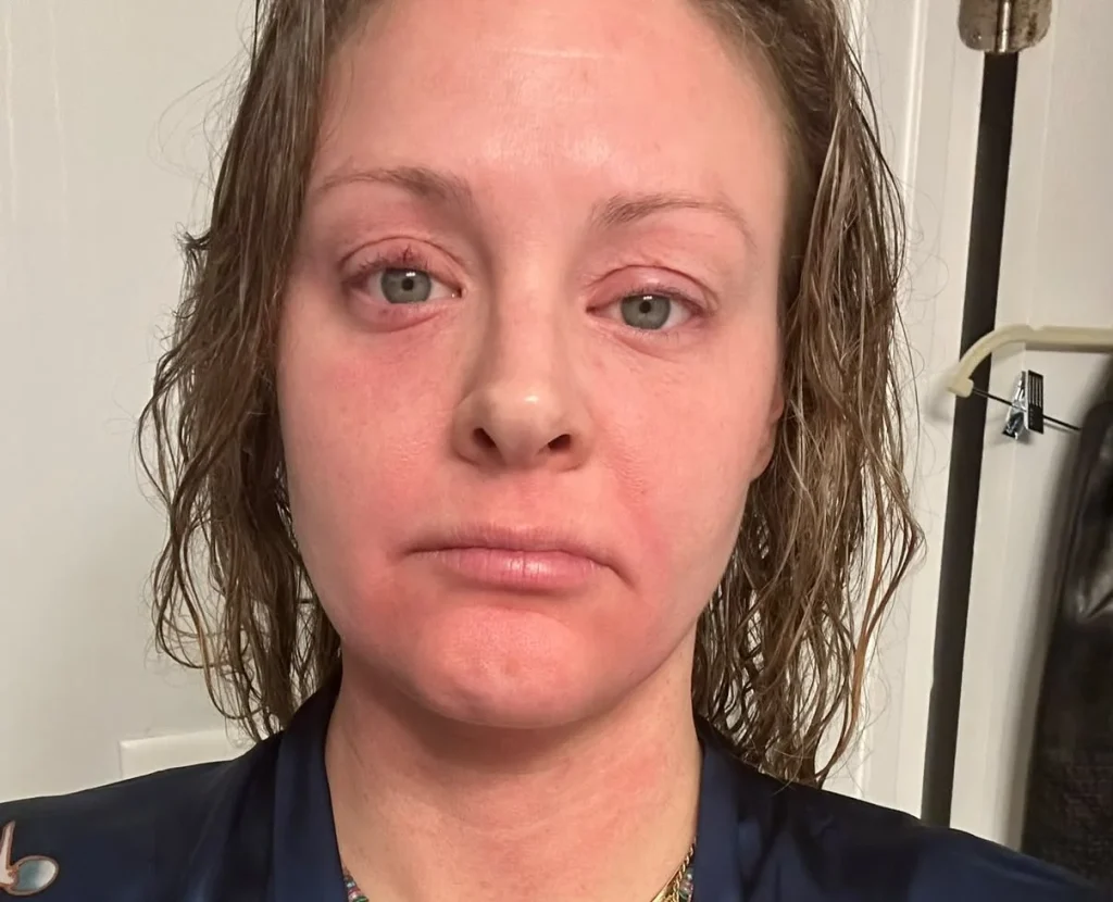 Mother claims wellness drink addiction triggered alcoholism, leading to rehab stay. Feel Free Tonics containing kratom caused withdrawal symptoms and substance abuse spiral.