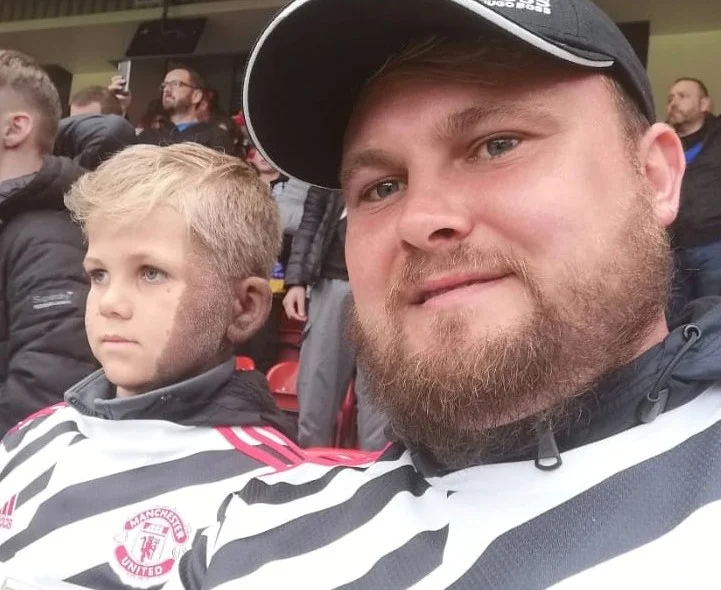 Mum feared for son's future after rare hairy birthmark covered half his face at birth, but he's now the most popular kid in school.