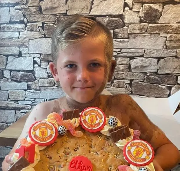 Mum feared for son's future after rare hairy birthmark covered half his face at birth, but he's now the most popular kid in school.