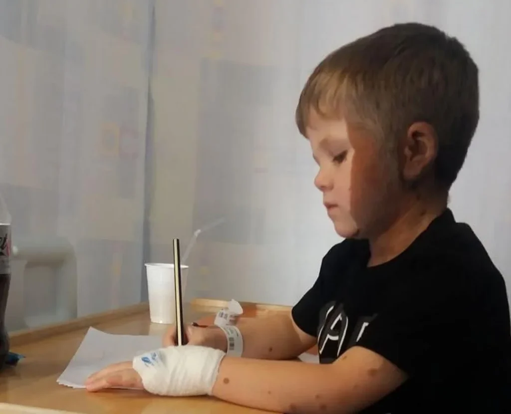 Mum feared for son's future after rare hairy birthmark covered half his face at birth, but he's now the most popular kid in school.