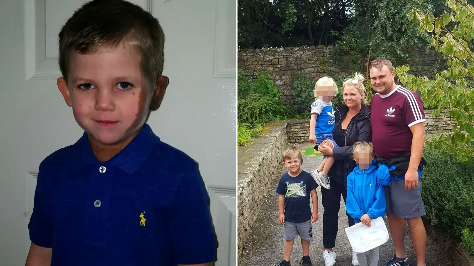Left: Ethan aged 10 in a navy polo shirt. Right: hospital photo showing his congenital melanocytic naevi birthmarks on his head and neck.