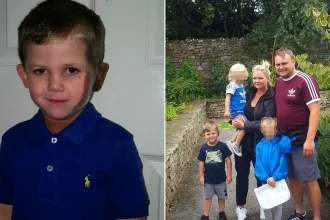 Left: Ethan aged 10 in a navy polo shirt. Right: hospital photo showing his congenital melanocytic naevi birthmarks on his head and neck.