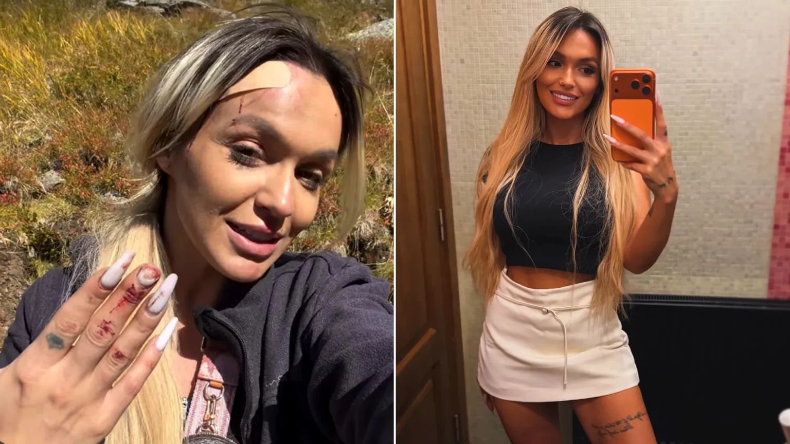 Reality star Ella Vișan miraculously survives after plunging 330ft down Mount Negoiu in Romania during a hiking accident on snowy terrain. She suffered injuries but was discharged from hospital.
