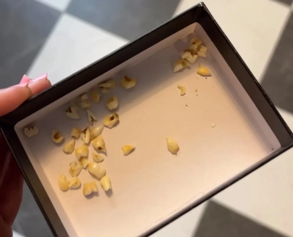 Jewellery designer transforms teeth into stunning keepsake rings prettier than diamonds - even made one for Amanda Holden. Custom pieces start at $130.