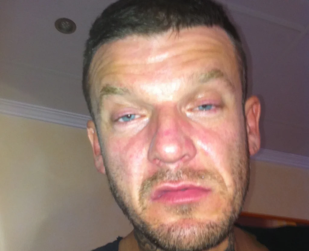 Welsh reality TV star Mathew Pritchard transforms after 30 years of partying. Four years sober, the Dirty Sanchez creator now plans a barefoot life in Greece.