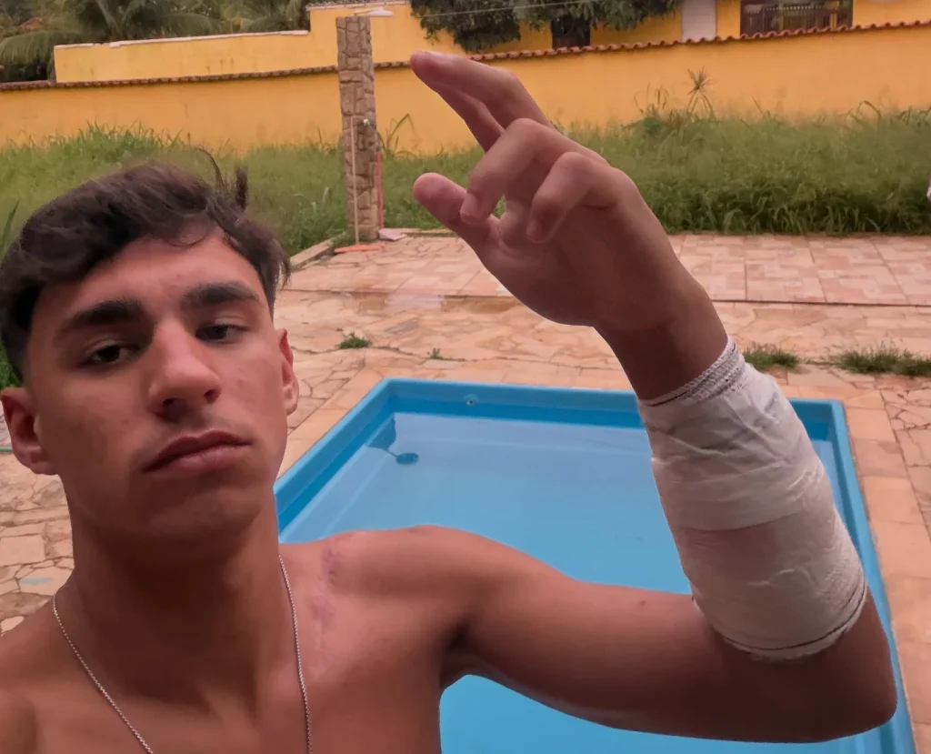 Teenage surf champion Rickson Falcão survives being shot four times in a drive-by shooting at a snack bar in Brazil. One person was killed in the attack.