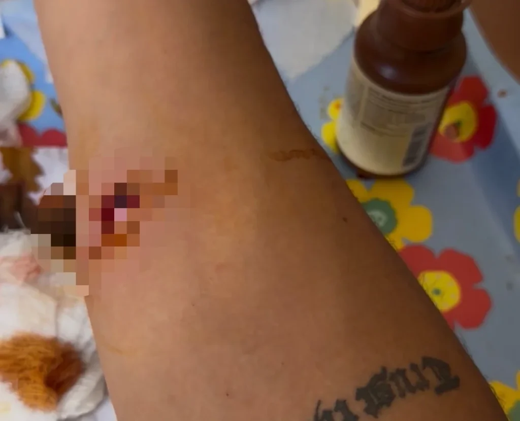 Teenage surf champion Rickson Falcão survives being shot four times in a drive-by shooting at a snack bar in Brazil. One person was killed in the attack.