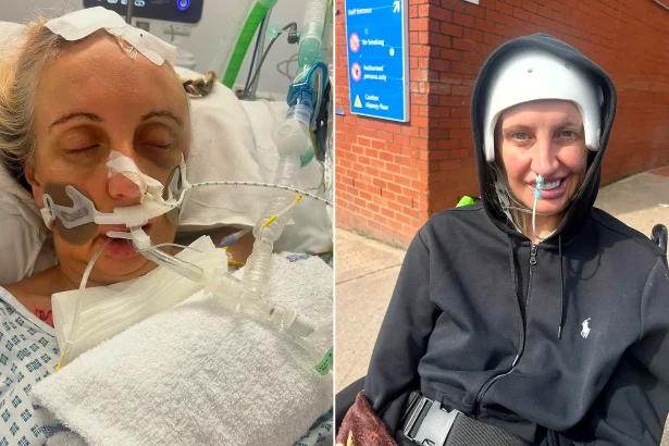 Woman in hospital bed with breathing apparatus, contrasted with same woman smiling outdoors wearing recovery bandages.
